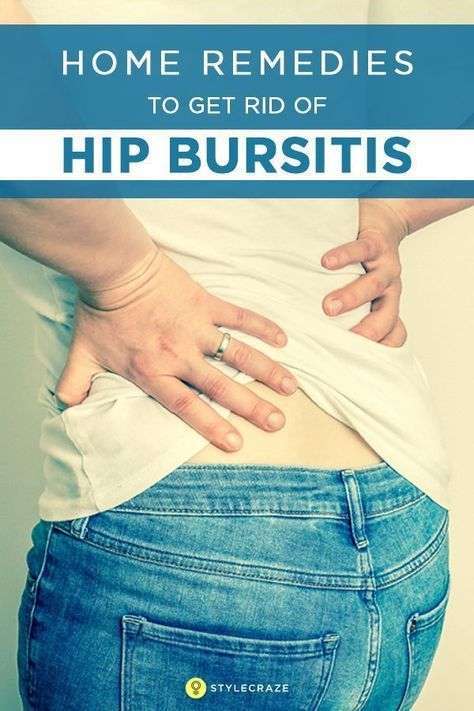 10 Effective Home Remedies To Get Rid Of Hip Bursitis ...
