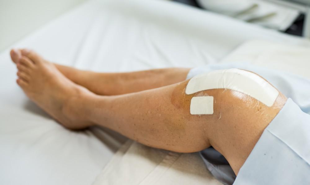 5 Tips to Speed Your Recovery After Knee Replacement ...