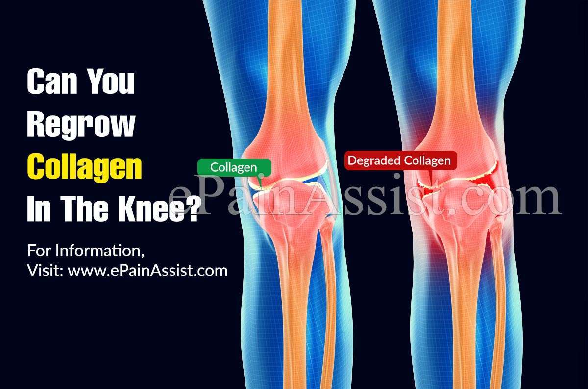 Can You Regrow Collagen In The Knee?