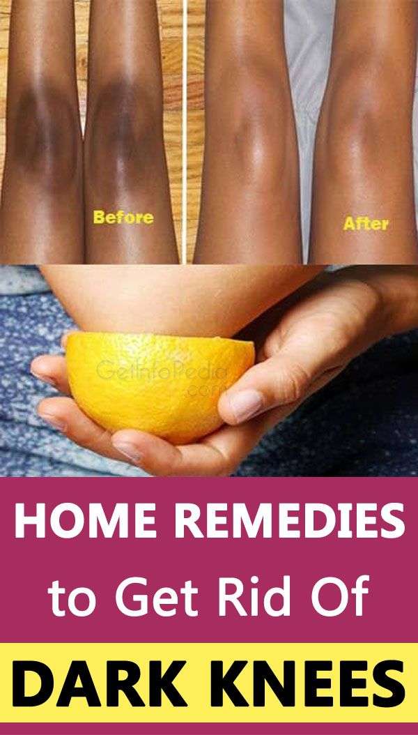 Home Remedies to Get Rid Of Dark Knees