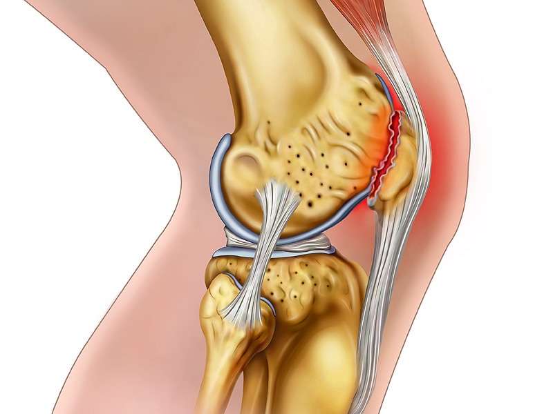 How To Regenerate Knee Cartilage Naturally