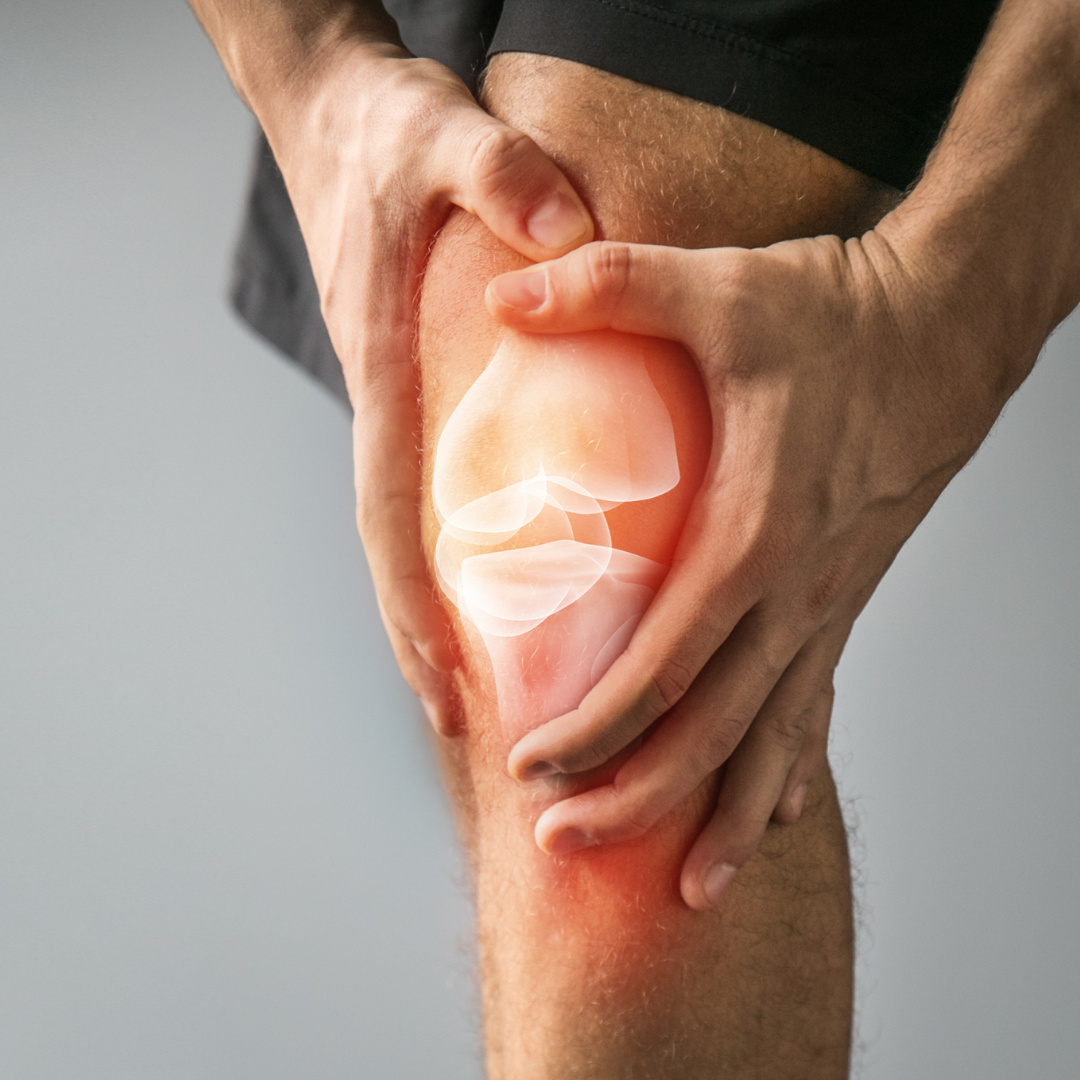 How to Treat Knee Arthritis Without Surgery