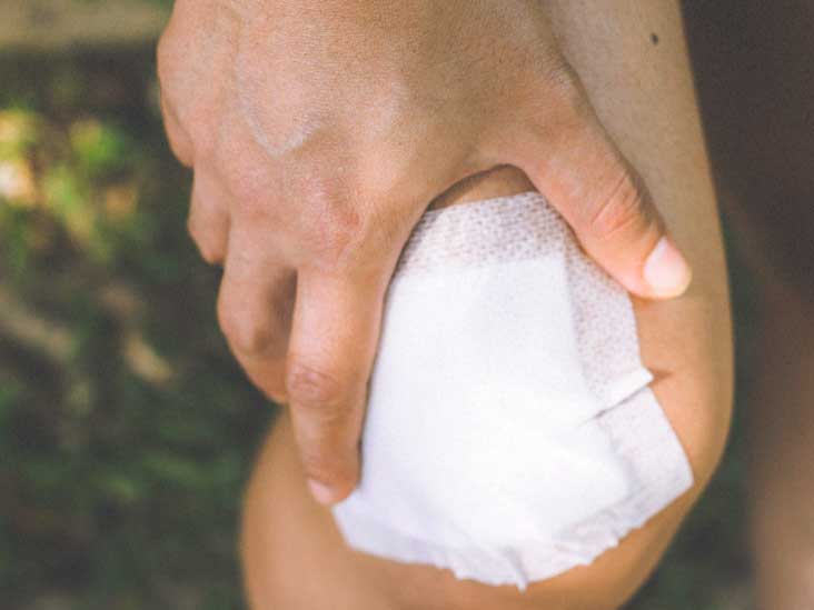 Infected Knee: Symptoms, Causes, and Treatment