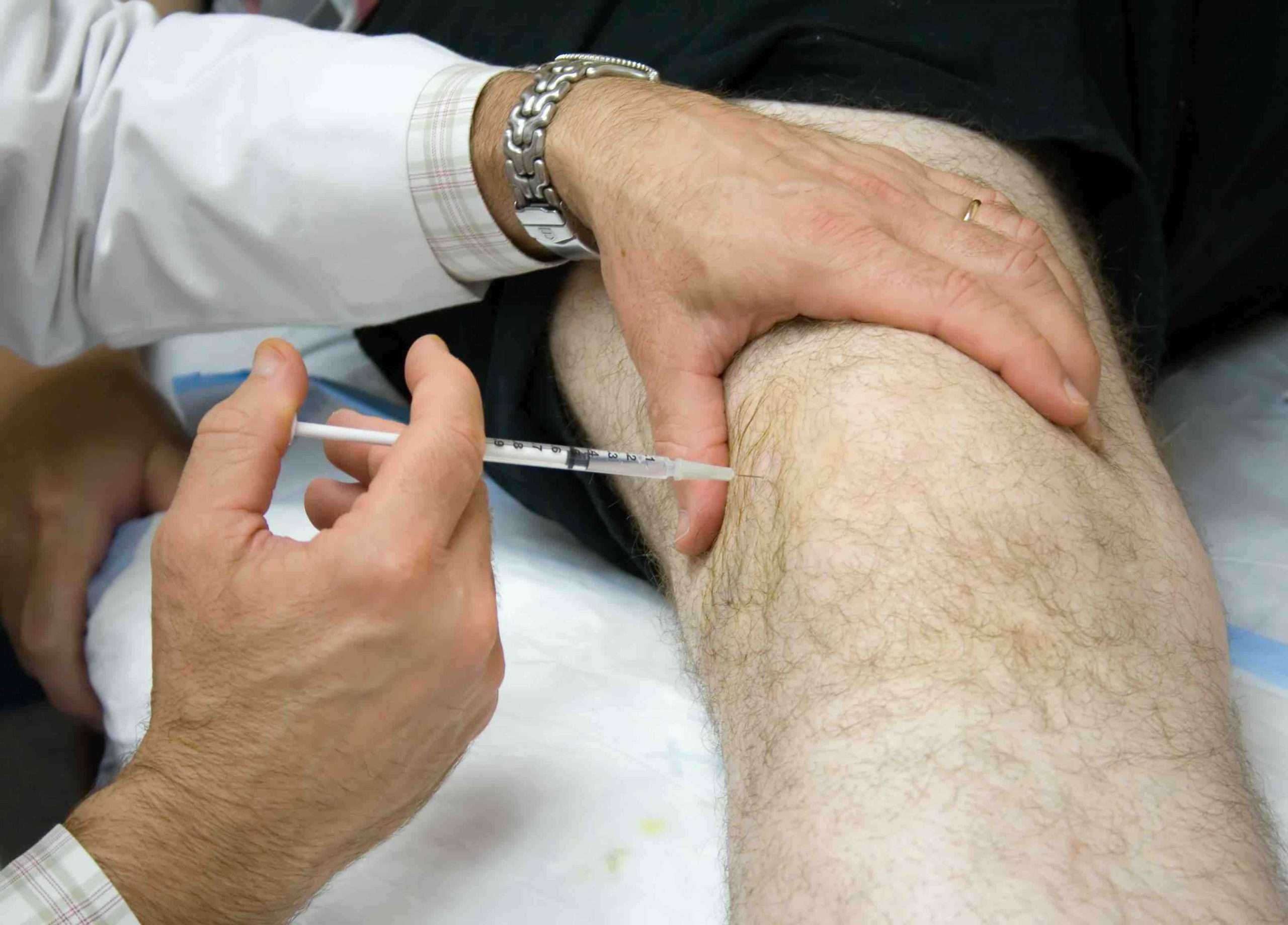 Knee  Injections for Arthritis of the Knee