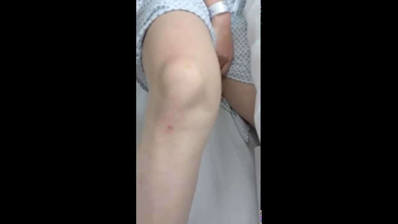 Knee Popping Out