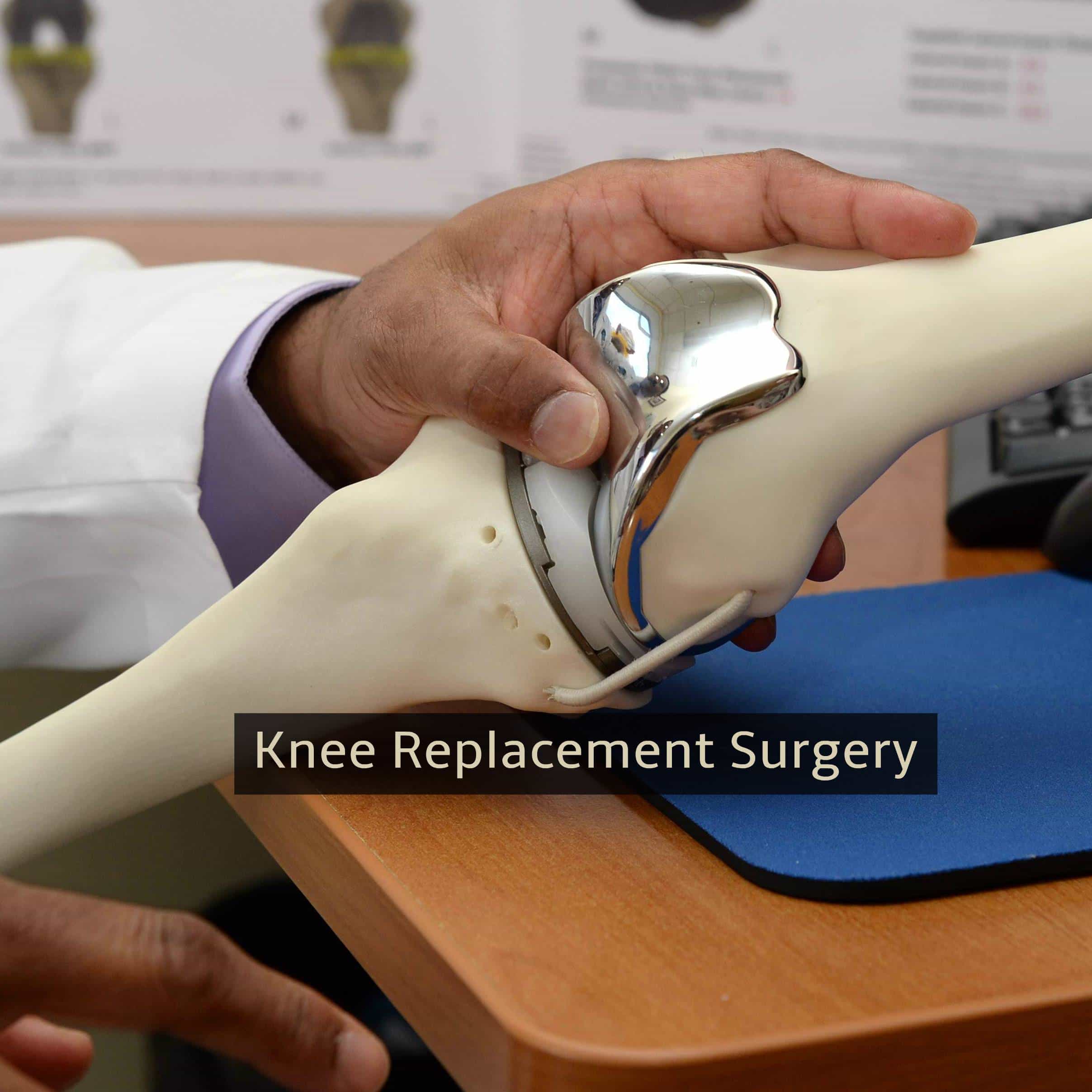 Knee Replacement Surgery  What to Expect During Recovery ...