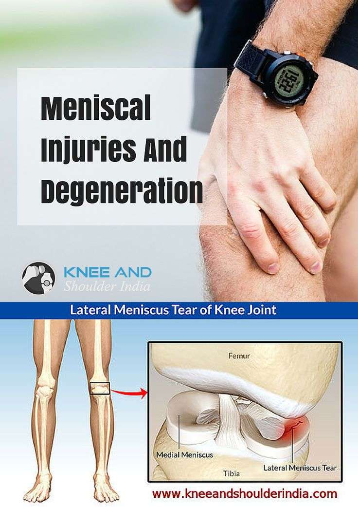 Meniscus Tears are among the most common knee injuries ...