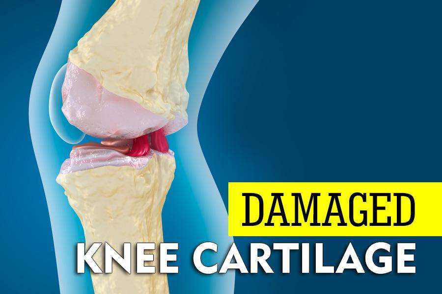 The Best Exercises for Damaged Knee Cartilage  ActiveGear